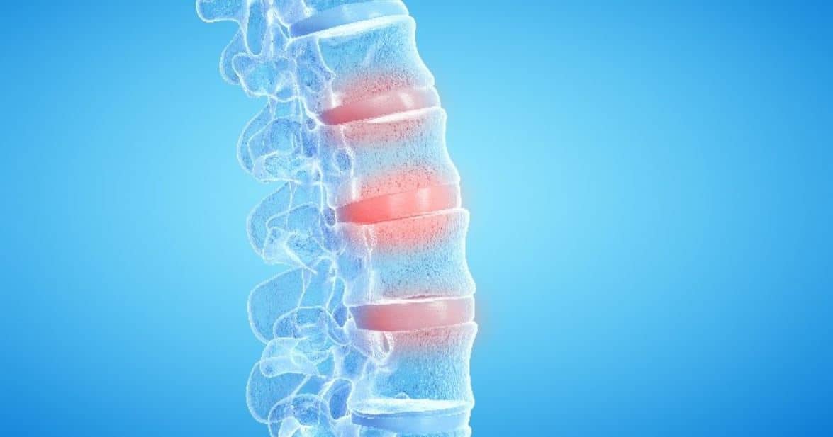 Spine Diagnosis Spine diagnosis for 3D printing process